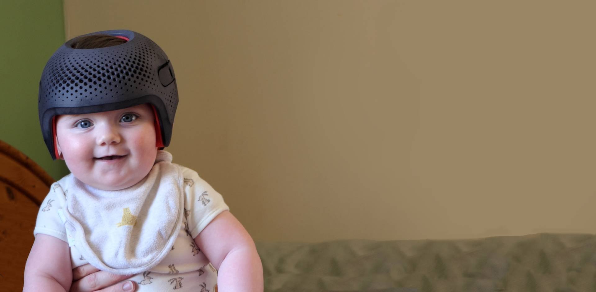 baby-cranial-remould