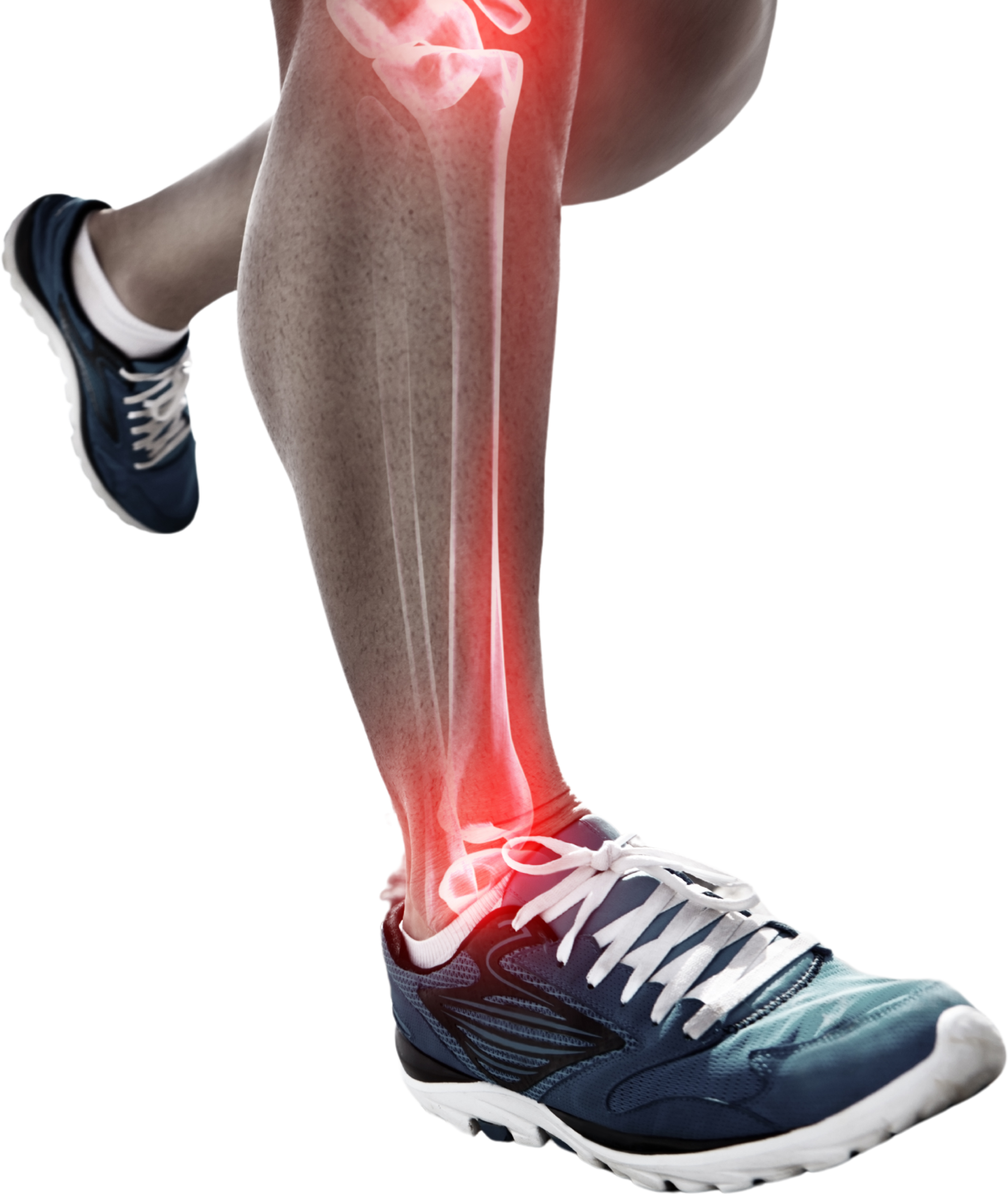orthotics
